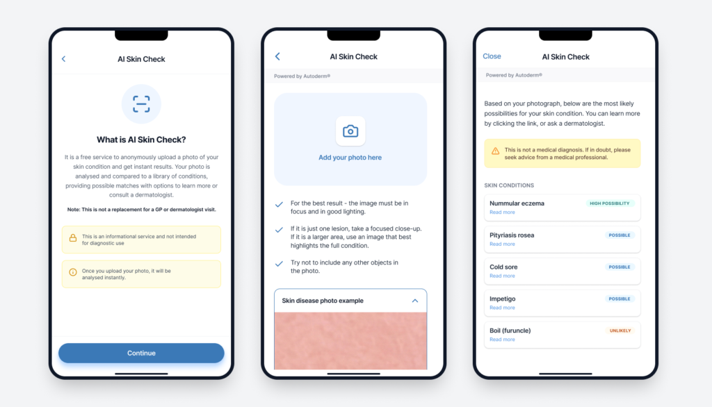 Three mobile app screenshots of the Autoderm AI skin check feature, from the introduction screen through photo upload to AI-generated results