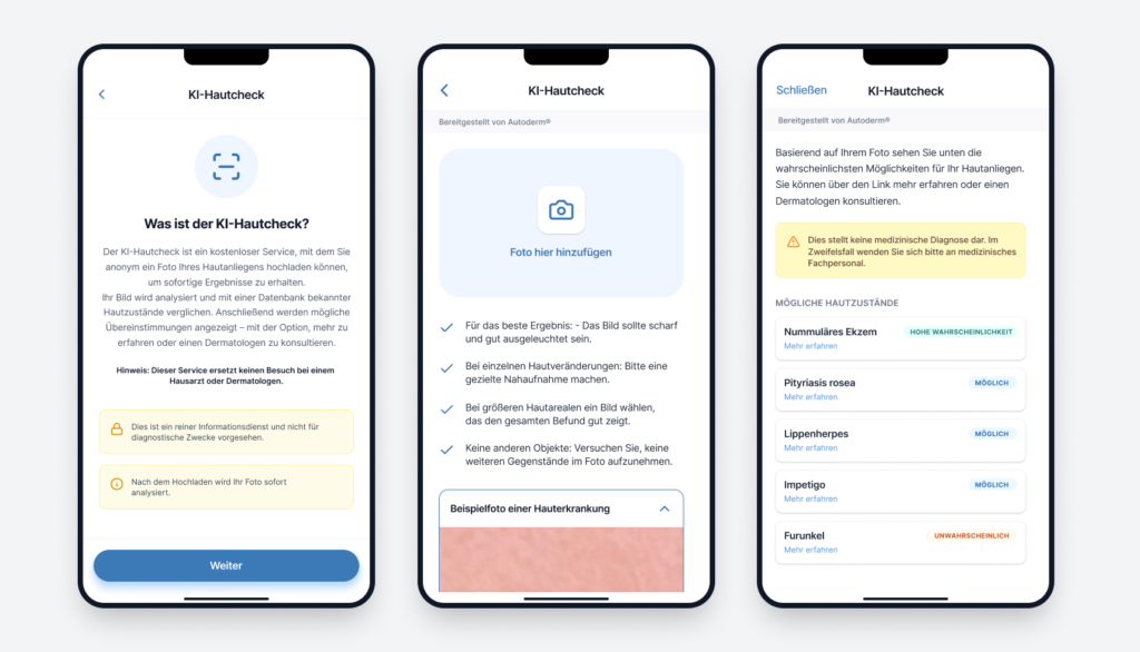 Drei deutschsprachige Mobile-App-Screenshots der Autoderm KI-Hautcheck-Funktion, von der Einführung über den Foto-Upload bis zu den KI-generierten Ergebnissen