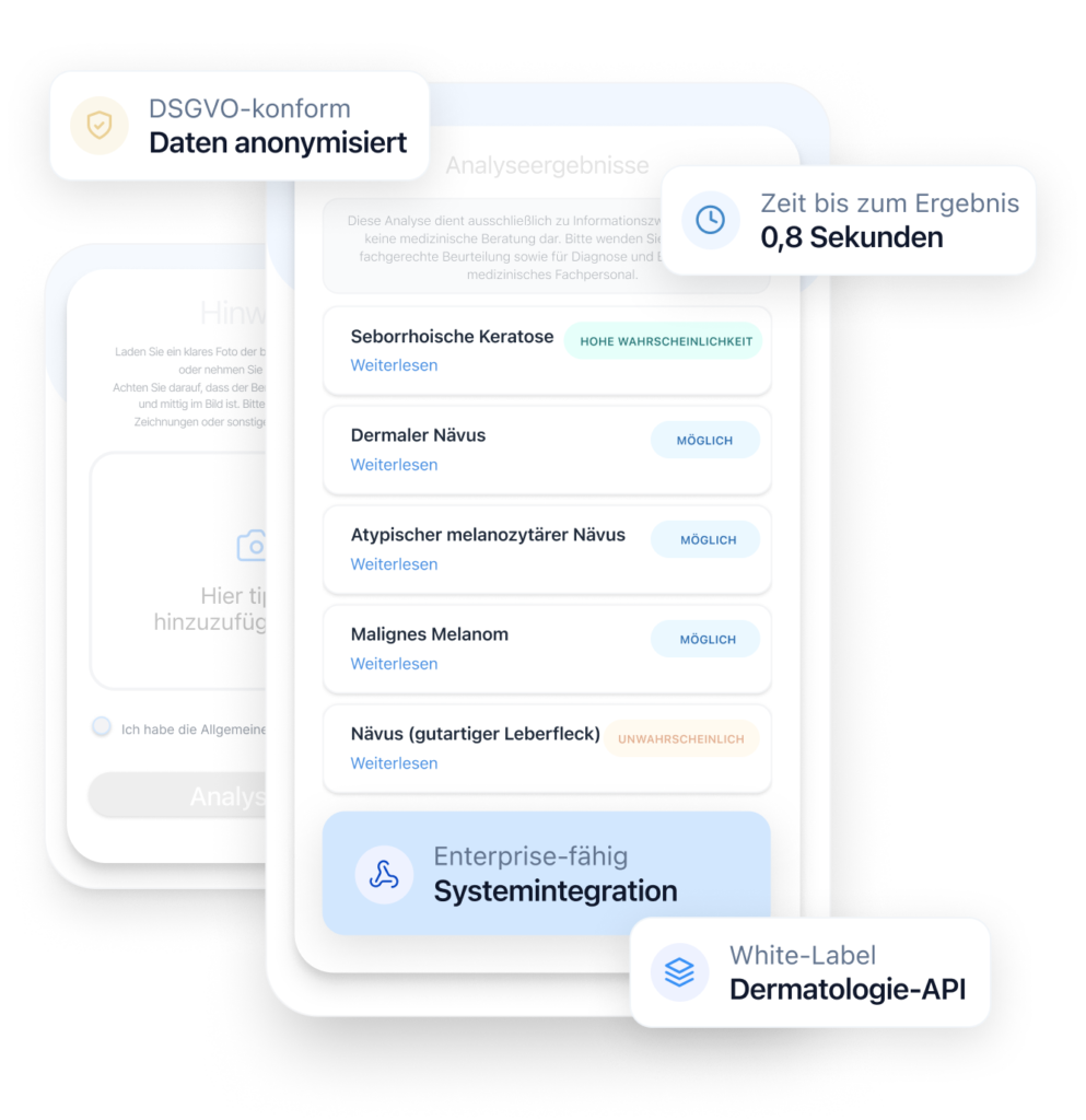 Screenshot der Autoderm KI-Dermatologie-API: Analyseergebnisse mit Zustandsvorschlägen und Wahrscheinlichkeitsstufen