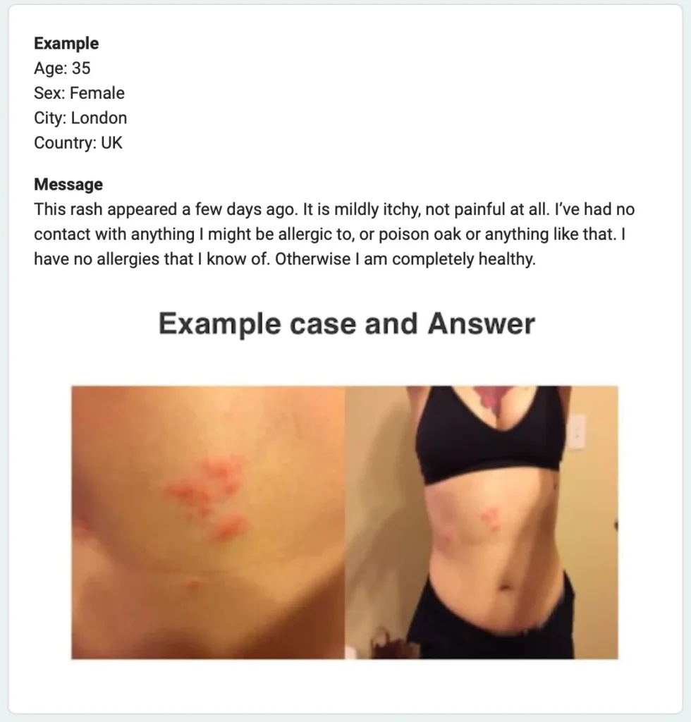 AutoDerm study Group A questionnaire example showing a 35-year-old female patient from London presenting with a mildly itchy rash of a few days duration, with close-up and overview photos of clustered red lesions on the torso and no AI-generated differential diagnoses provided