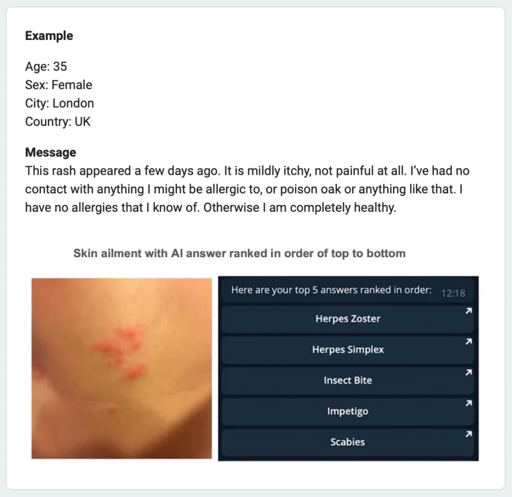 AutoDerm study Group B questionnaire example showing the same patient case alongside AutoDerm version 2.2 top 5 AI-generated differential diagnoses ranked in order: Herpes Zoster, Herpes Simplex, Insect Bite, Impetigo, and Scabies