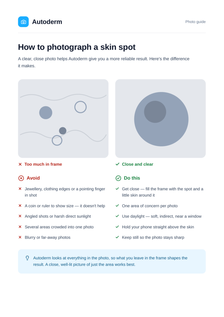 Autoderm photo guide showing a bad example with several skin spots and clutter in one frame beside a good example with a single spot photographed close and clear