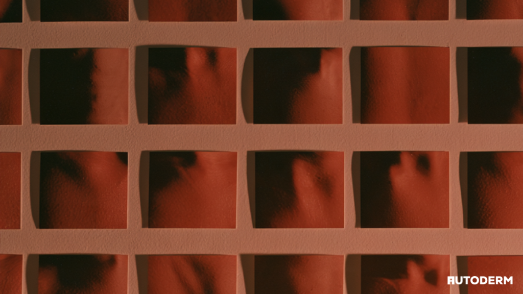 Macro skin photo grid illustrating image quality evaluation for a dermatology API integration